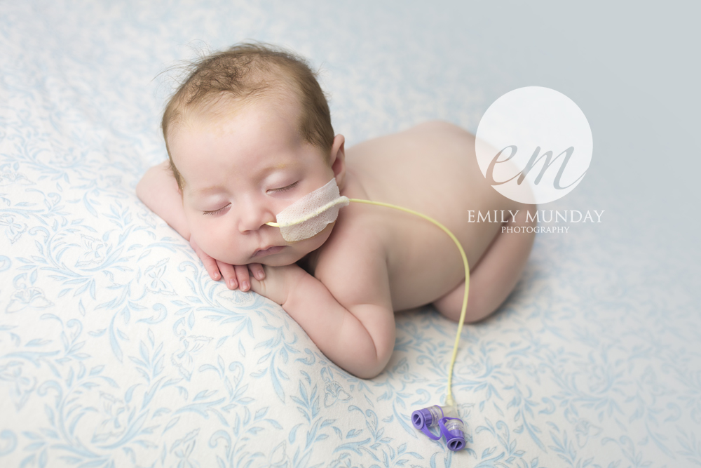 isabella cleft palate NHS newborn photos baby pictures plymouth devon emily munday monday photographer photography feeding tube posed awake