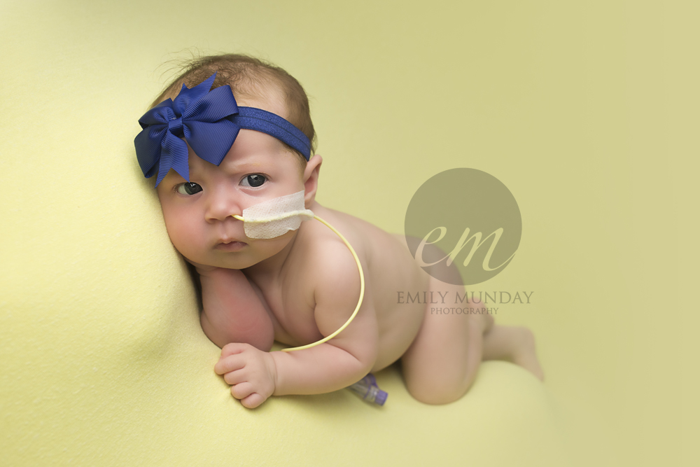 isabella cleft palate NHS newborn photos baby pictures plymouth devon emily munday monday photographer photography feeding tube posed awake